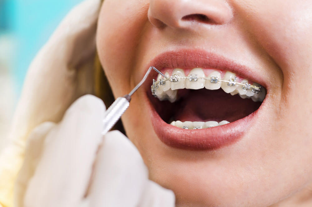 Ortodontik Problemlerin Oluşma Sebepleri